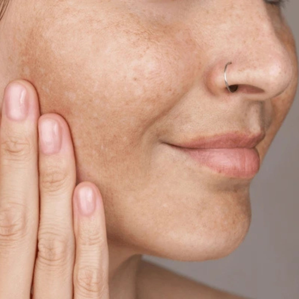 Dark Spots