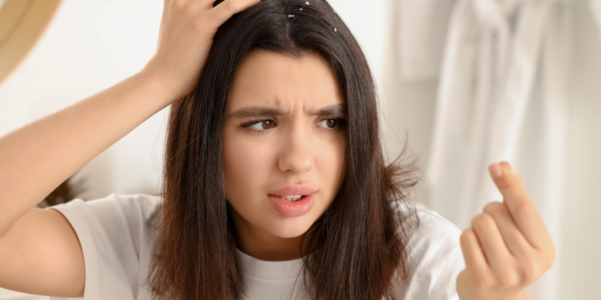 Dandruff causes hair fall and its impact on scalp health.